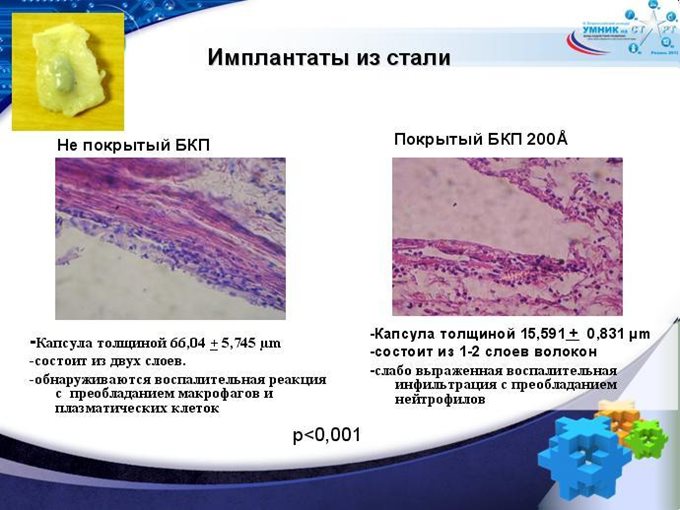 Имплантанты из стали
